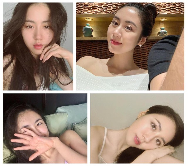Beauty blogger vẫn khủng hoảng mụn như thường, và đó là lúc Mai Vân Trang tìm ra 3 “bảo bối” cứu da tuyệt đỉnh này! - Ảnh 1.