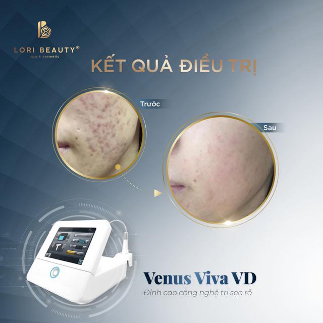 Lori Beauty Spa tưng bừng khai trương chi nh&aacute;nh mới - Ảnh 4.