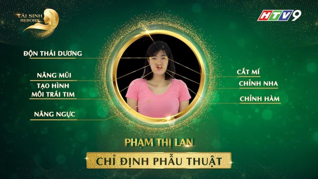 Trấn Thành, Minh Hằng đồng ý tài trợ 1 tỷ đồng phẫu thuật thẩm mỹ cho cô gái đến từ Ba Vì - Ảnh 4.