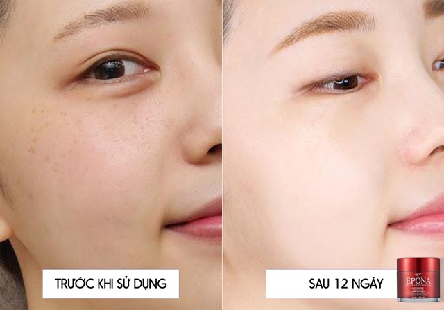 Cộng đồng mạng đua nhau review lọ kem dưỡng trắng chống lão hóa Epona Cream all in one, liệu có hiệu quả như lời đồn? - Ảnh 2.