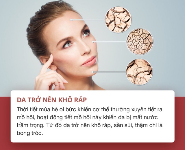 Những dấu hiệu cho thấy làn da bạn đang “kêu cứu trong ngày hè và cách khắc phục - Ảnh 3.