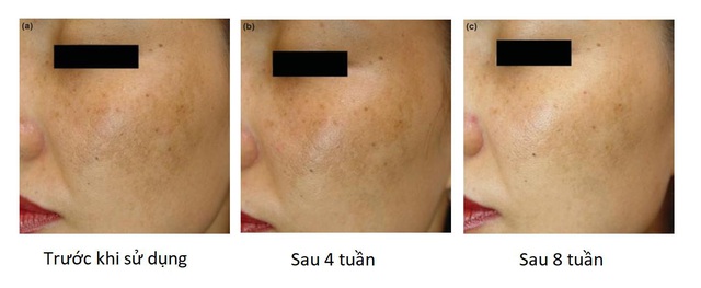 Hành trình tái lập chuẩn mực chăm sóc da của phụ nữ Việt - Ảnh 2.