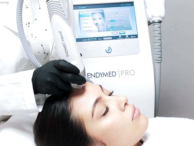ENDYMED PRO - Công nghệ đột phá mới trong điều trị sẹo mụn - Ảnh 4.