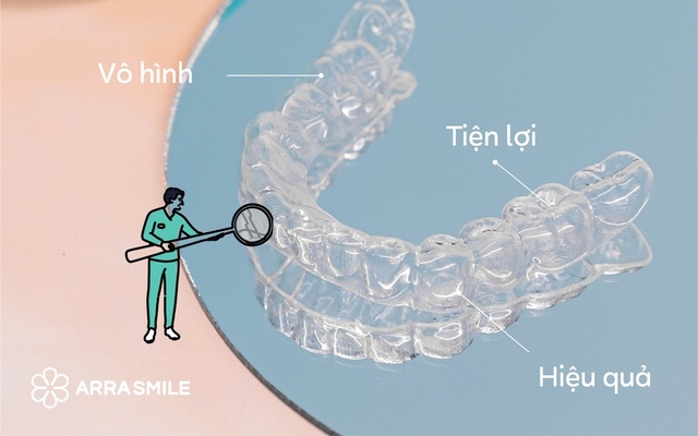 ARRASMILE - Niềng răng chuẩn Nhật - Nổi bật tự tin - Ảnh 2.