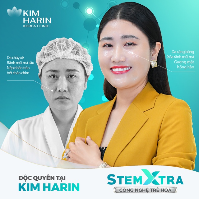 Kim Harin - Thẩm mỹ viện trẻ hoá công nghệ cao nâng tầm nhan sắc cho hàng nghìn phụ nữ Việt - Ảnh 4.