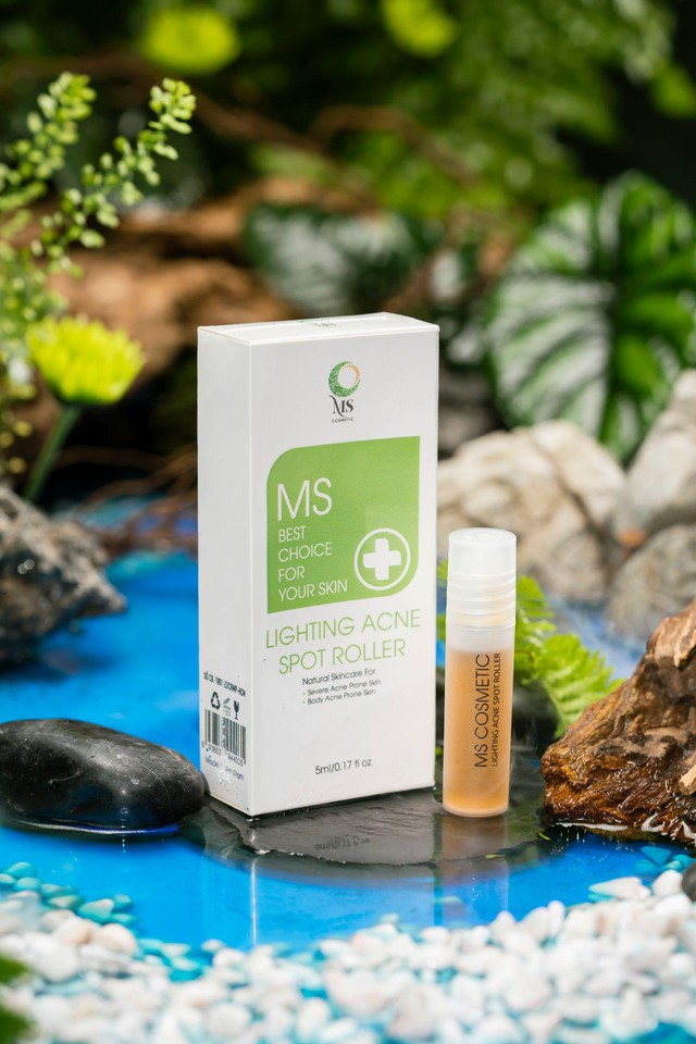 Thanh lăn mụn Ms Cosmetic giúp giảm các dấu hiệu mụn, thâm cứng đầu - Ảnh 1.