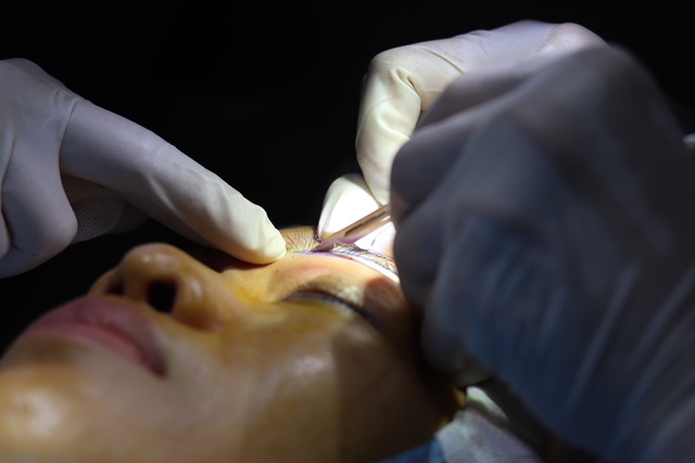 Những rủi ro khi chọn c&aacute;c cơ sở thẩm mỹ cắt m&iacute; v&agrave; nhấn m&iacute; k&eacute;m uy t&iacute;n - Ảnh 1.