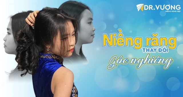 Cô bé “lãi” góc nghiêng vạn người mê nhờ niềng răng - Ảnh 1.