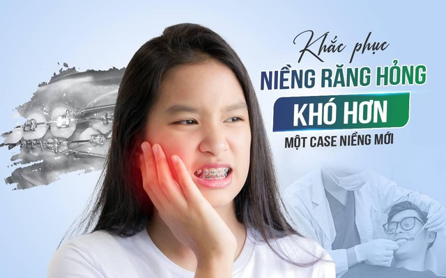 Niềng hỏng, tiền mất tật mang: Chuyện xui rủi đ&acirc;u ai muốn - Ảnh 2.
