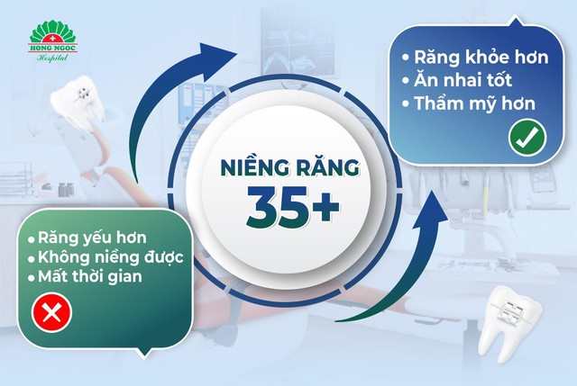 Niềng răng tuổi 35: Hiểu đúng sẽ không còn là nỗi lo - Ảnh 2.