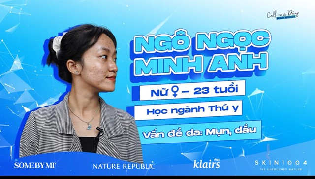 Call Me Duy chơi lớn lấy trường hợp da nặng để hỗ trợ cải thiện da trong &ldquo;Call Me Duy is here&rdquo; m&ugrave;a 2 - Ảnh 3.