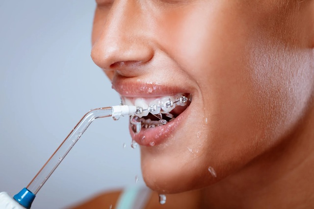Nha khoa ST Dentist - Nơi niềng răng gi&aacute; tốt cho Gen Z - Ảnh 3.