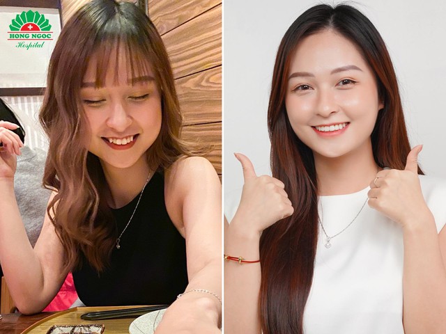 Niềng răng có thể thay đổi được gương mặt? - Ảnh 1.