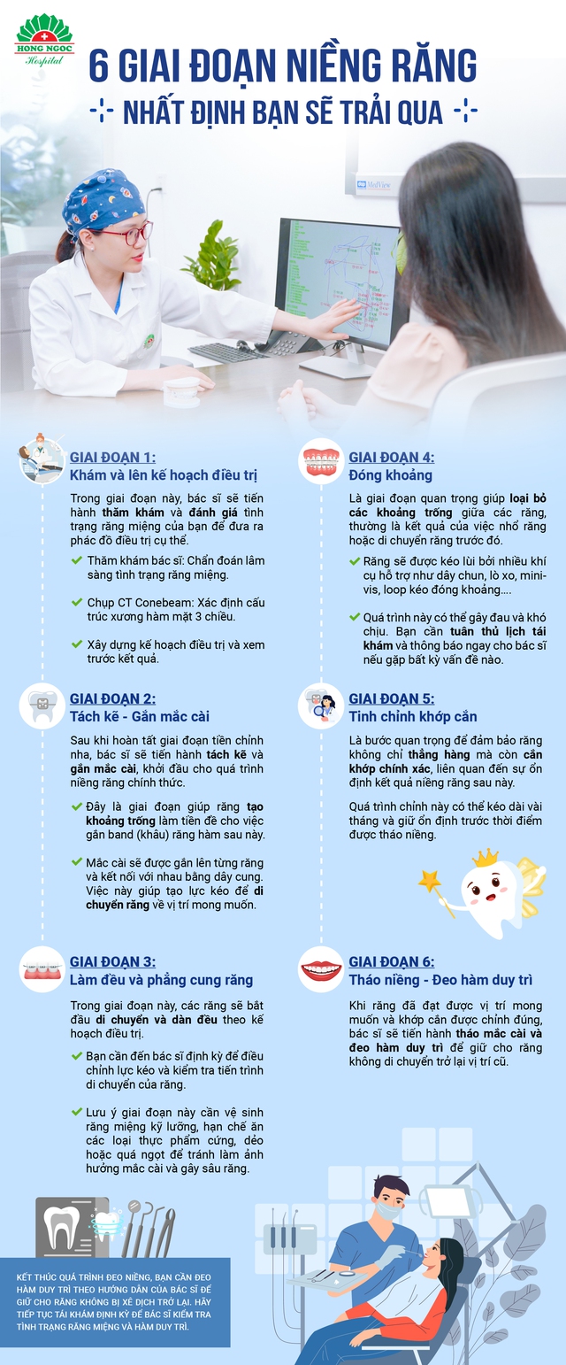 6 giai đoạn bạn sẽ trải qua khi niềng răng - Ảnh 2.