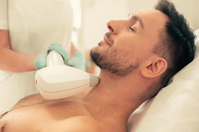 Triệt râu nam giới giá bao nhiêu? Gợi ý địa chỉ thực hiện uy tín- Ảnh 1.