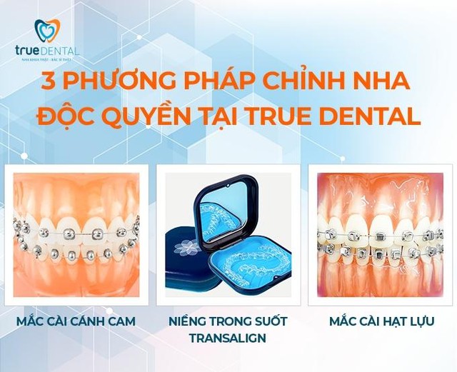 True Dental - Địa chỉ niềng răng êm ái, thoải mái tại TP. HCM - Ảnh 2.