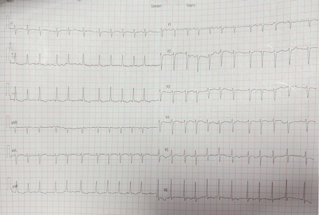 Cứu sống bệnh nhân suy hô hấp nặng do nguyên nhân tim mạch- Ảnh 1.