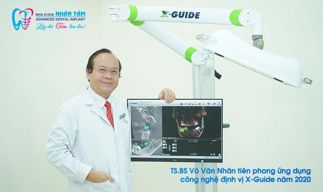 FastMap® tích hợp công nghệ định vị X-Guide NXT - Cách mạng trong cấy ghép răng implant- Ảnh 1.