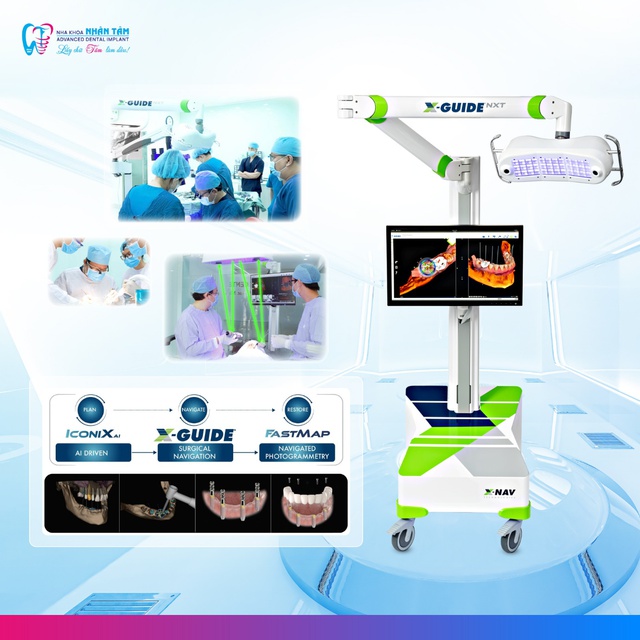 FastMap® tích hợp công nghệ định vị X-Guide NXT - Cách mạng trong cấy ghép răng implant- Ảnh 2.