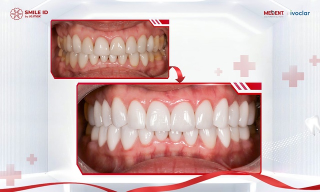 Nha khoa thẩm mỹ và bài toán niềm tin - Ảnh 2.