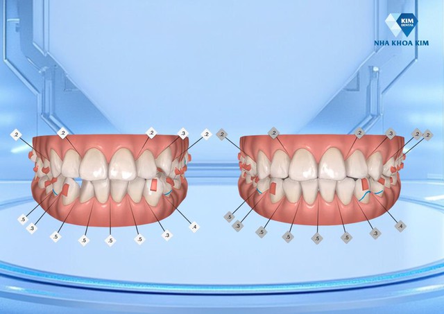 Nha khoa nổi tiếng nhờ ứng dụng công nghệ để nâng cao an toàn điều trị- Ảnh 2.