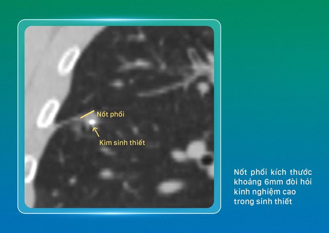 Dấu ấn y học chính xác và công nghệ cao tại Bệnh viện Phương Đông - Ảnh 1.