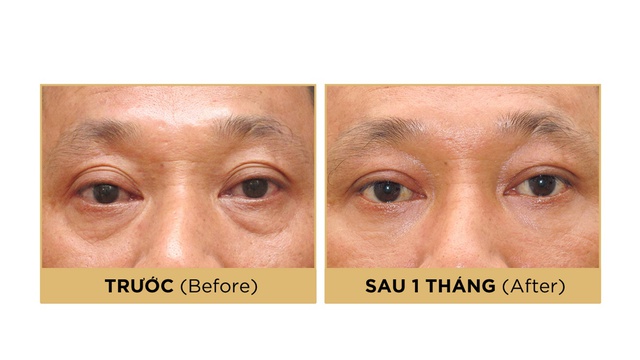 Đằng sau quyết định chỉnh mí là tầm nhìn lãnh đạo của nam doanh nhân- Ảnh 1.