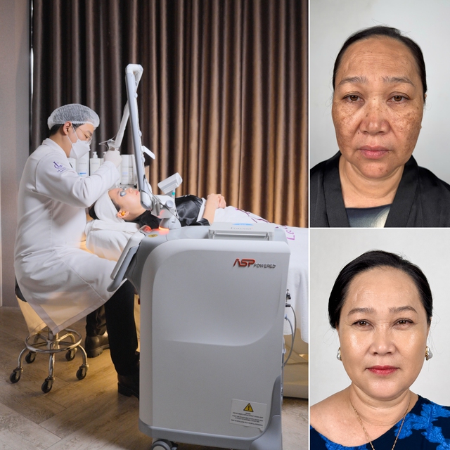 LG Clinic "bắt tay" với Fotona, sở hữu công nghệ Hybrid Pico Laser đỉnh cao từ Hoa Kỳ- Ảnh 1.