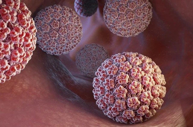 Tỷ lệ tử vong do ung thư cổ tử cung ở phụ nữ trẻ gần như bằng không, nhờ tiêm ngừa HPV sớm- Ảnh 1.