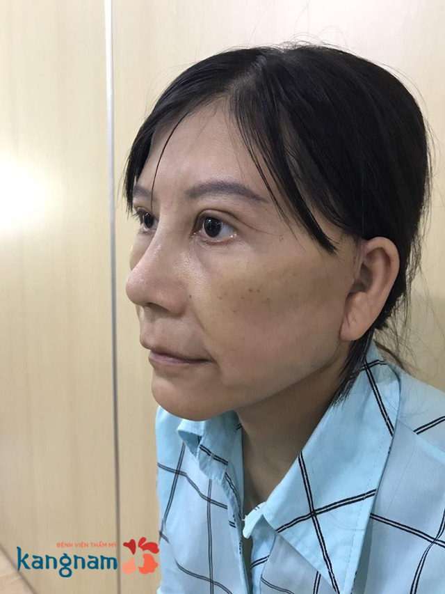 H&agrave;nh tr&igrave;nh lột x&aacute;c 2017: Đẹp l&agrave; cần thiết nhưng an to&agrave;n mới l&agrave; ti&ecirc;u ch&iacute; h&agrave;ng đầu - Ảnh 4.