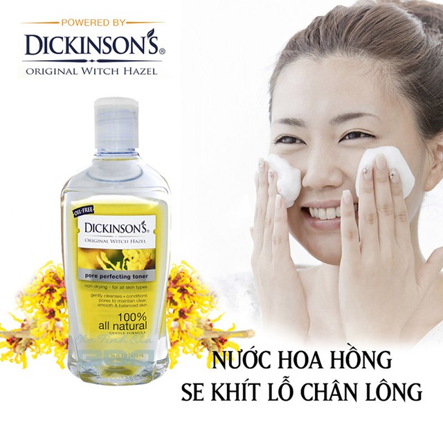 Tất tần tật về Dickinsons bạn cần phải biết - Ảnh 2.
