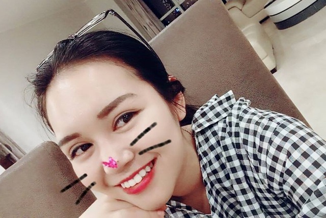 C&ocirc; g&aacute;i lai T&acirc;y cực xinh sau phẫu thuật thẩm mỹ đang hot rần rần tr&ecirc;n mạng l&agrave; ai? - Ảnh 7.