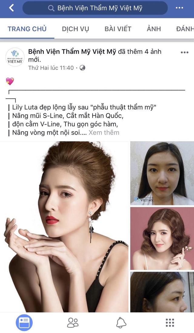 Hot girl Lilly Luta: Sau khi phẫu thuật thẩm mỹ, tôi đã may mắn và thành công hơn - Ảnh 2.