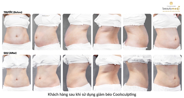 B&eacute;o bụng, ngấn mỡ đ&ugrave;i, mập c&aacute;nh tay v&agrave; đ&acirc;y ch&iacute;nh l&agrave; thủ phạm - Ảnh 3.