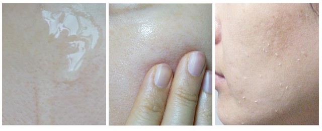 Sự kỳ diệu của gel tẩy da chết Care:nel - Royal Face Peeling Spa - Ảnh 3.