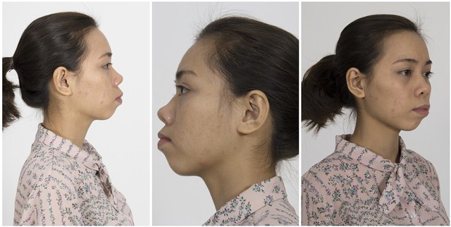 Giải m&atilde; c&ocirc;ng nghệ thẩm mỹ sử dụng cho c&ocirc; g&aacute;i mặt vượn Kim Phượng - Ảnh 2.