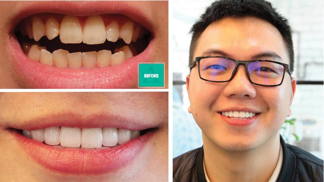 Nhìn loạt ảnh trước và sau khi làm răng sứ - Bạn cũng chỉ muốn đến ngay nha sĩ thôi - Ảnh 6.