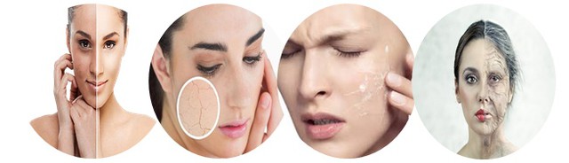 Những điều bạn chưa biết về dưỡng ẩm - Ảnh 2.