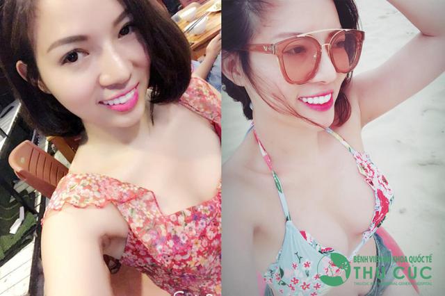 Cứ v&agrave;o h&egrave; chị em lại c&oacute; th&ecirc;m l&yacute; do k&eacute;o nhau đi n&acirc;ng ngực - Ảnh 2.