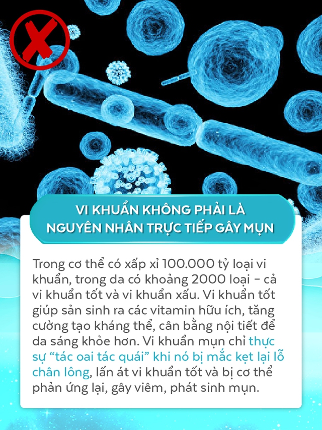 Giải đáp từ A đến Z cơ chế gây mụn ở tuổi dậy thì, hóa ra vi khuẩn không xấu như chúng ta vẫn nghĩ - Ảnh 2.