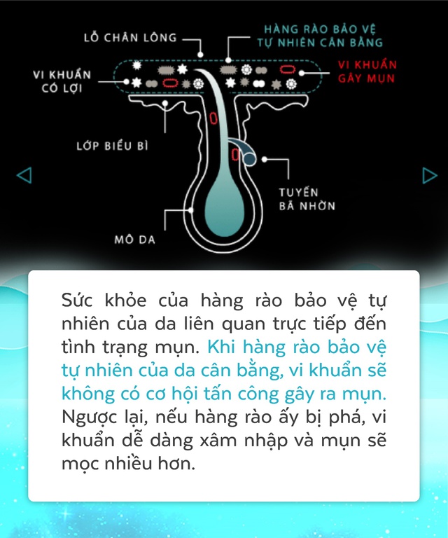 Những sự thật bất ngờ về mụn v&agrave; giải ph&aacute;p tiễn đ&egrave;n pin vĩnh viễn - Ảnh 8.
