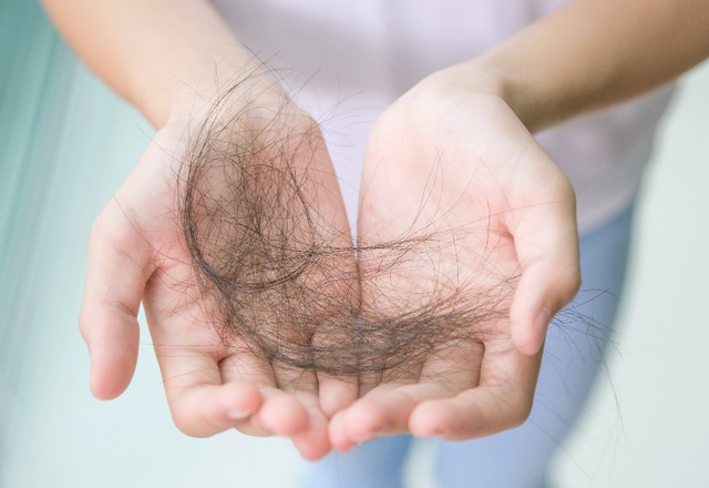 Rụng t&oacute;c, h&oacute;i đầu phải đ&acirc;u l&agrave; chuyện nhỏ! - Ảnh 1.