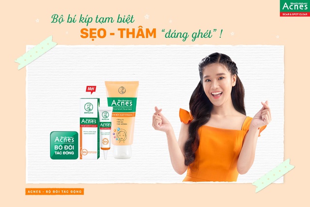 Cùng Acnes nhìn lại hành trình đáng nhớ của 14 ngày thử thách sáng thâm - mờ sẹo - Ảnh 3.